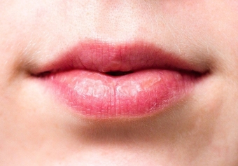 Wrinkles Above the Lips: The Best Treatments & Prevention